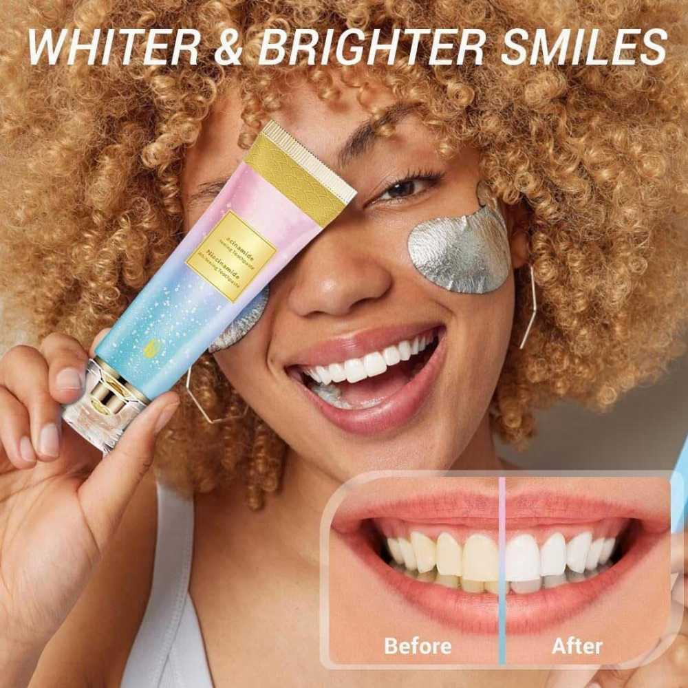 Niacinamide Whitening Toothpaste 100g, Removes Tartar, Removes Stains, Protects Enamel, Whitens Teeth, Gum Care, Strengthens Enamel, Prevents Cavities, Freshens Breath.